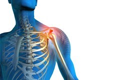 Shoulder Pain